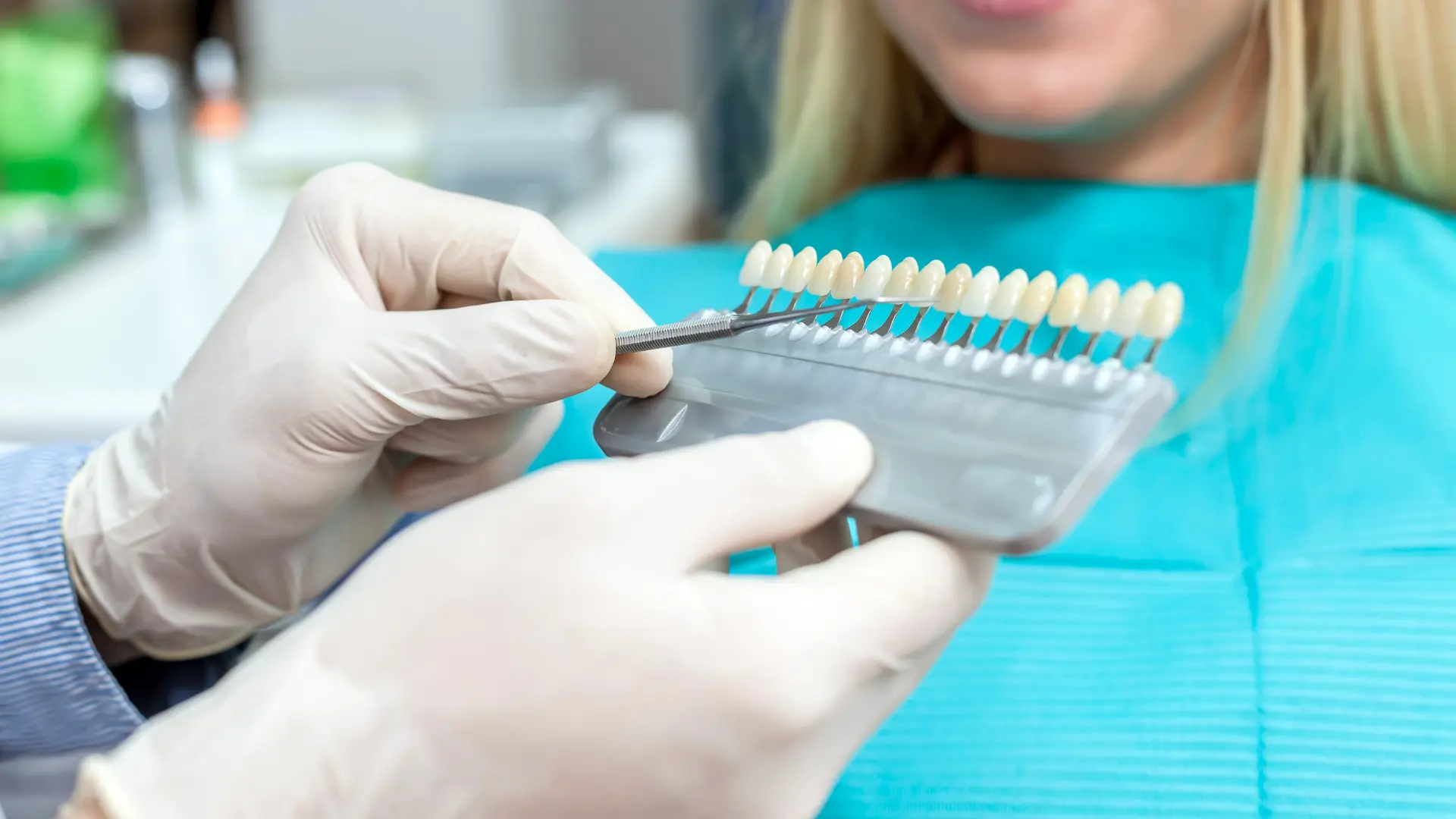 Laminate Veneer Nasıl Yapılır?