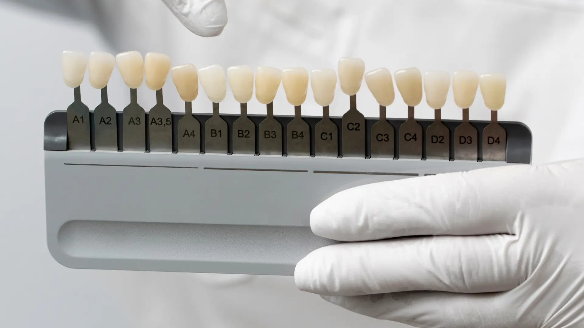 Laminate Veneer Tedavisinin Avantajları