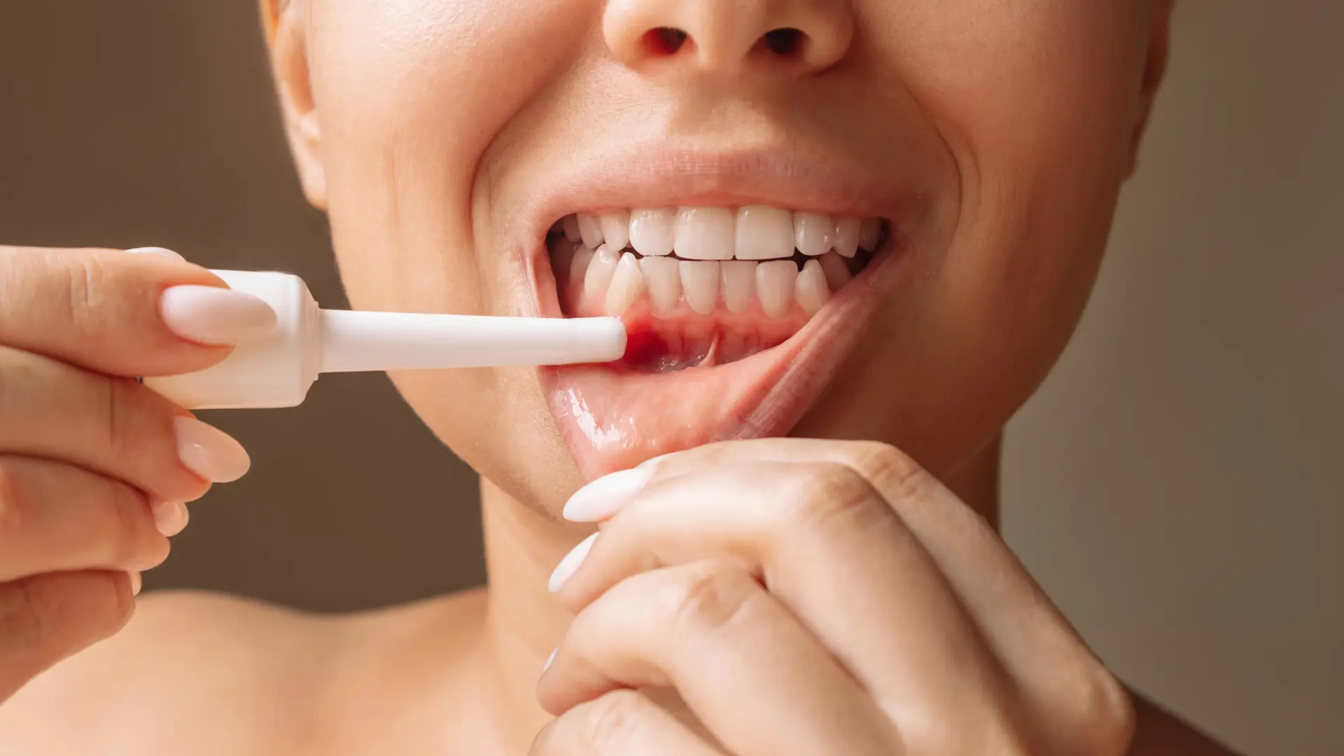 diş eti çekilmesi nasıl tedavi edilir