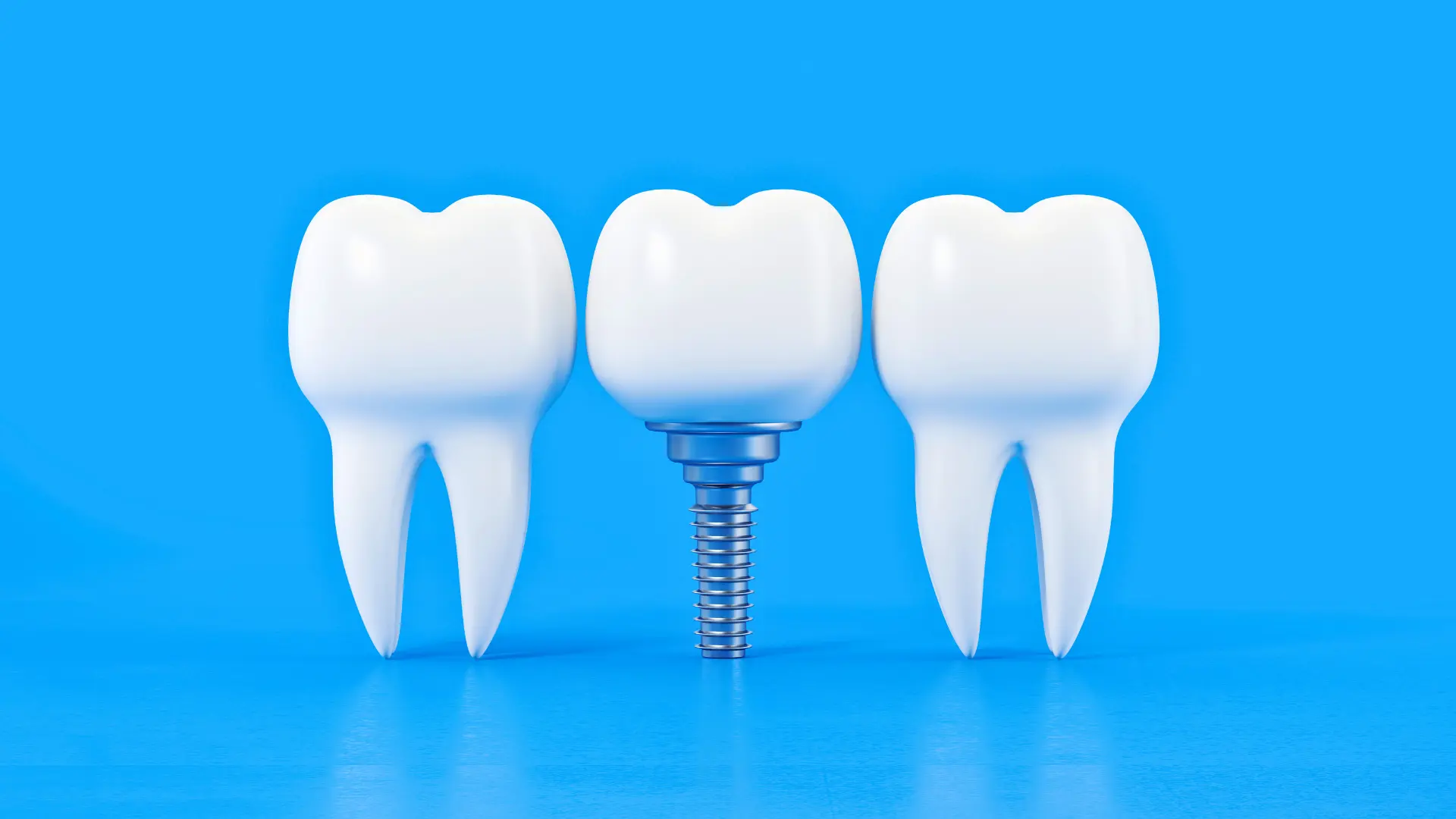 İmplant Kaç Yaşında Yapılmalıdır?